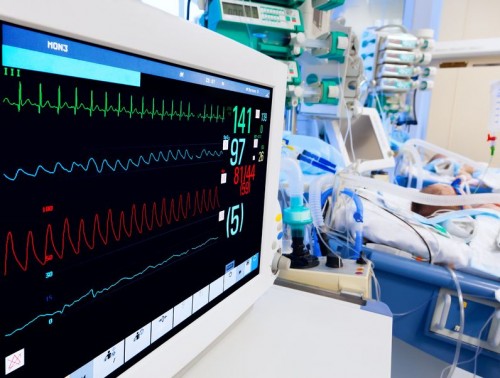 P&oacute;s-Gradua&ccedil;&atilde;o em Ventila&ccedil;&atilde;o n&atilde;o-Invasiva para Enfermeiros (Lx)